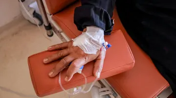 Rak pęcherza moczowego – jak wygląda życie pacjenta?