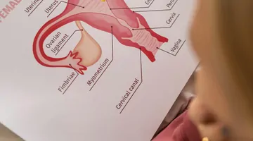 Nowotwór złośliwy jajnika – czy to zawsze wyrok śmierci? Alicja dzielnie walczy z trudami losu