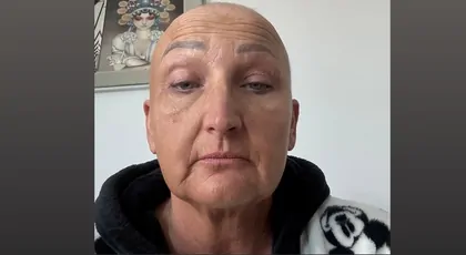 Zbiórka na perukę naturalną po utracie włosów i walce z rakiem szyjki macicy