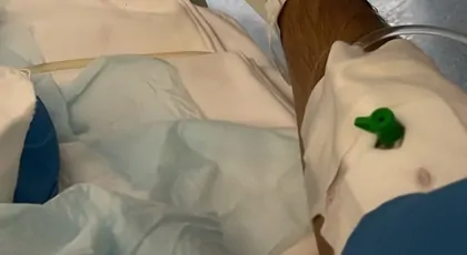 Białaczka limfoblastyczna rak