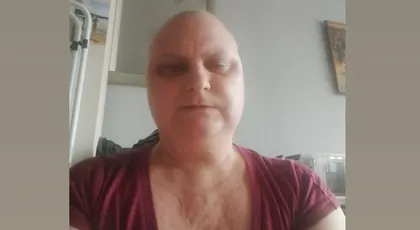 Ewa – rak piersi i węzłów chłonnych. Samotna mama walczy