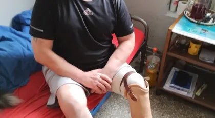 Nowoczesna proteza  a n