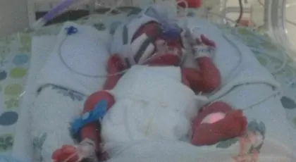 Rehabilitacja Ksawcia ❤️