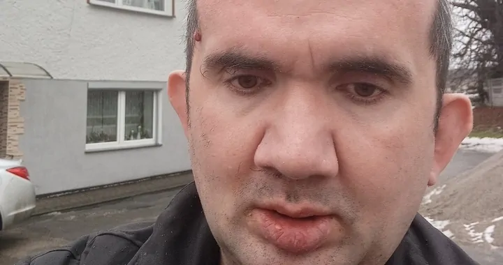 Mam  guza mózgu