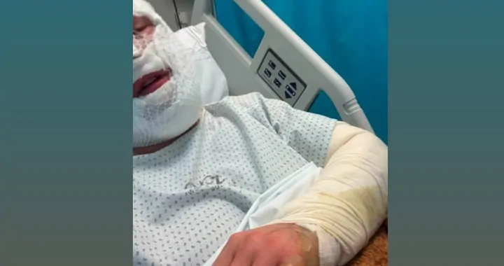 Dzień Matki zamienił się w walkę o zdrowie naszej mamy po ciężkich oparzeniach
