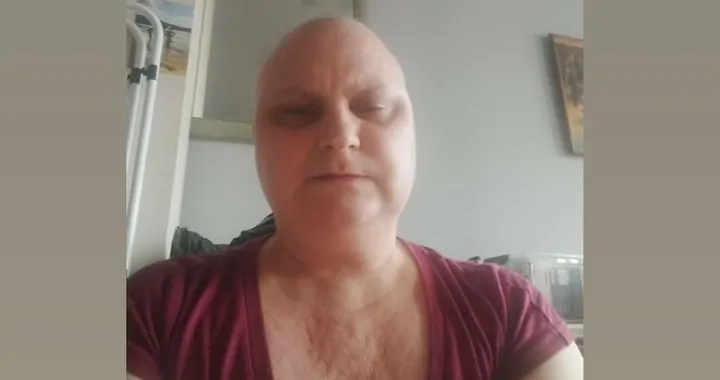 Ewa – rak piersi i węzłów chłonnych. Samotna mama walczy