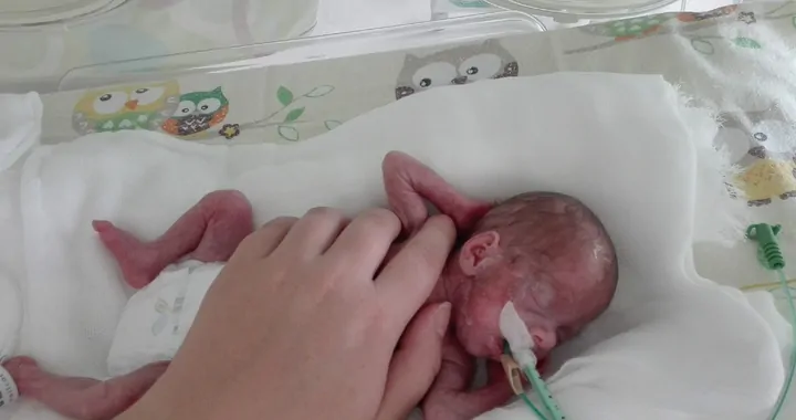 Dramatyczne skutki wcześniactwa nieodwracalnie zmieniły życie Anastazji