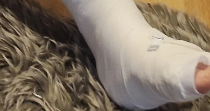 Rehabilitacja złamanej nogi