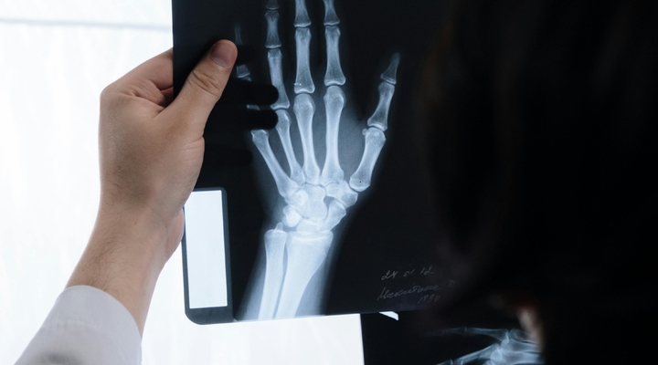 Ile kosztuje scyntygrafia kości?