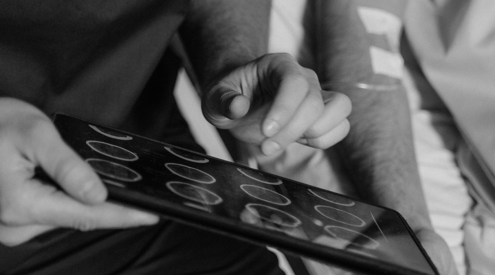 Rekonstrukcja pęcherza moczowego usuniętego z powodu raka. Jaki to koszt?