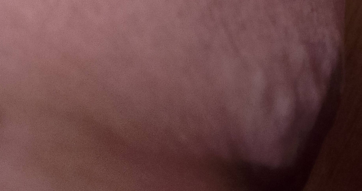 Zdjęcie osoby potrzbującej
