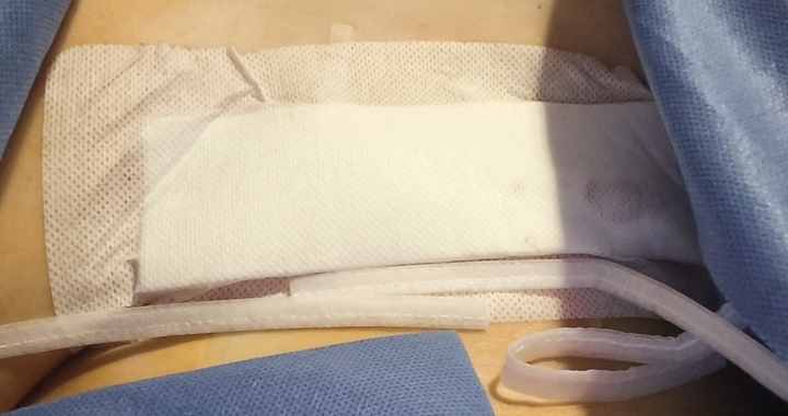 Zdjęcie osoby potrzbującej