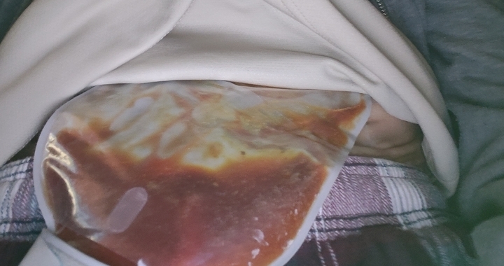 Zdjęcie osoby potrzbującej