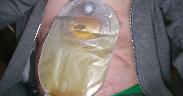 Zdjęcie osoby potrzbującej