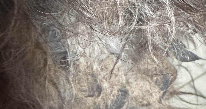 Zdjęcie osoby potrzbującej