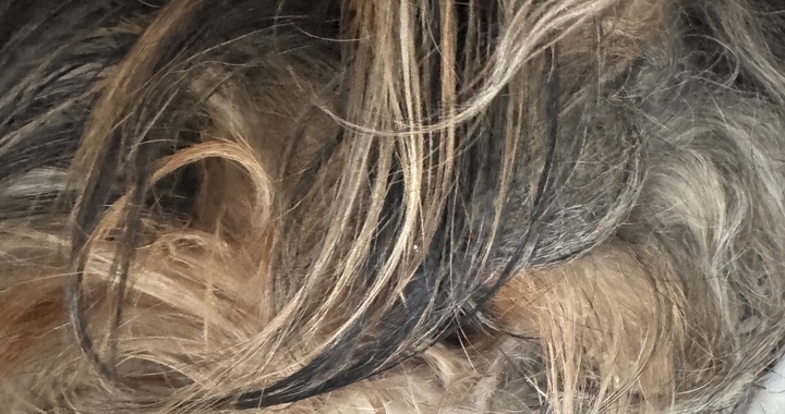 Zdjęcie osoby potrzbującej